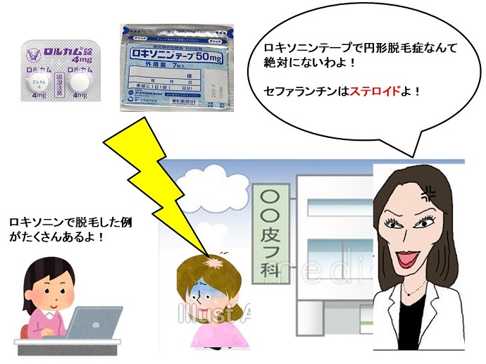 円形脱毛症　病院